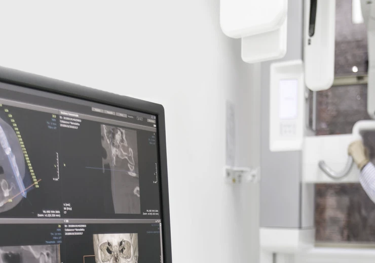 Chirurgie guidée au cabinet dentaire 126 à Paris (75011)