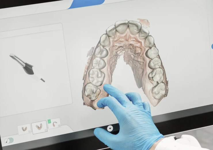 Empreinte optique au cabinet dentaire 126 à Paris (75011)