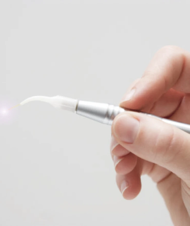 Laser, technologies du cabinet dentaire Le 126 à Paris 75011