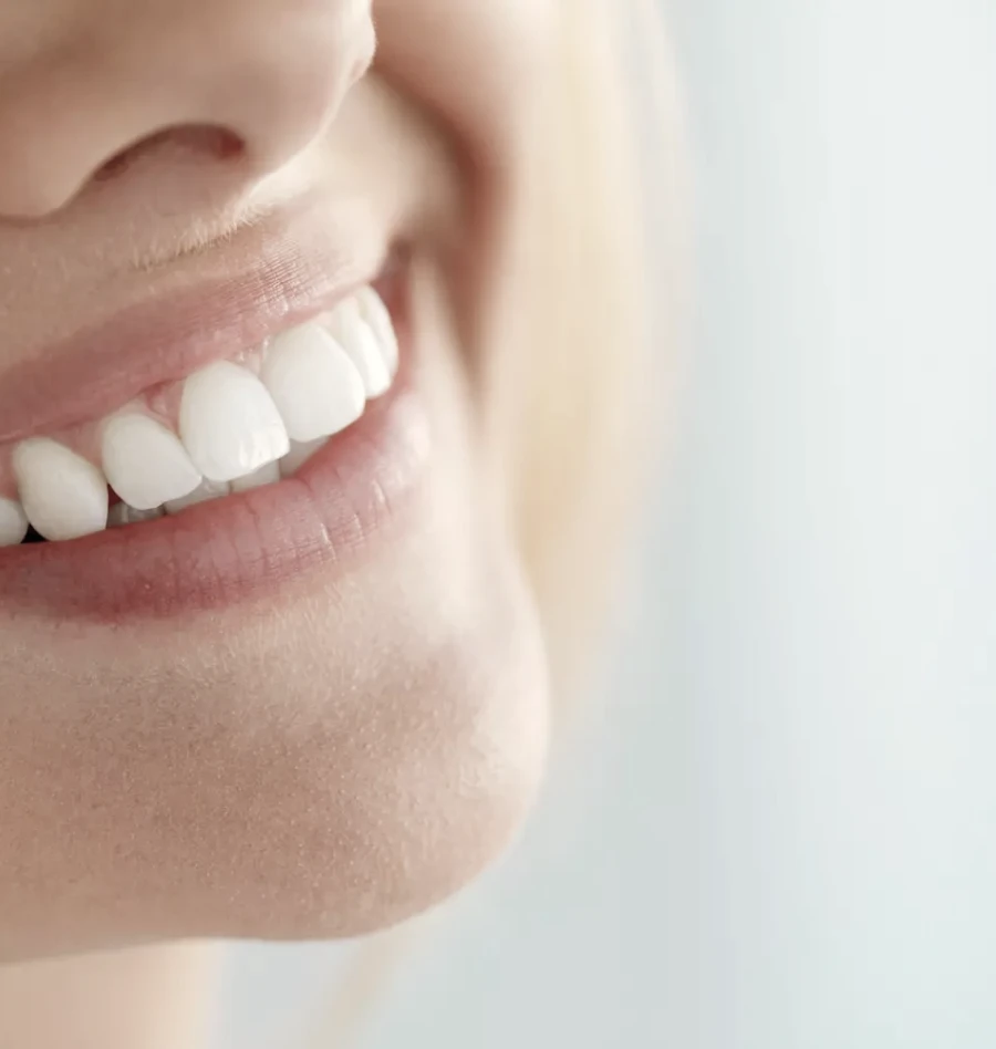 Facettes ceramiques, Dr Haddad Cabinet dentaire 126 à Paris 75011