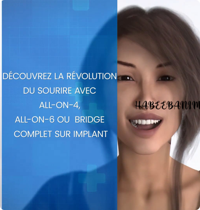 video-implant-denaire-paris-11-chirurgien-dentiste-raphael-haddad