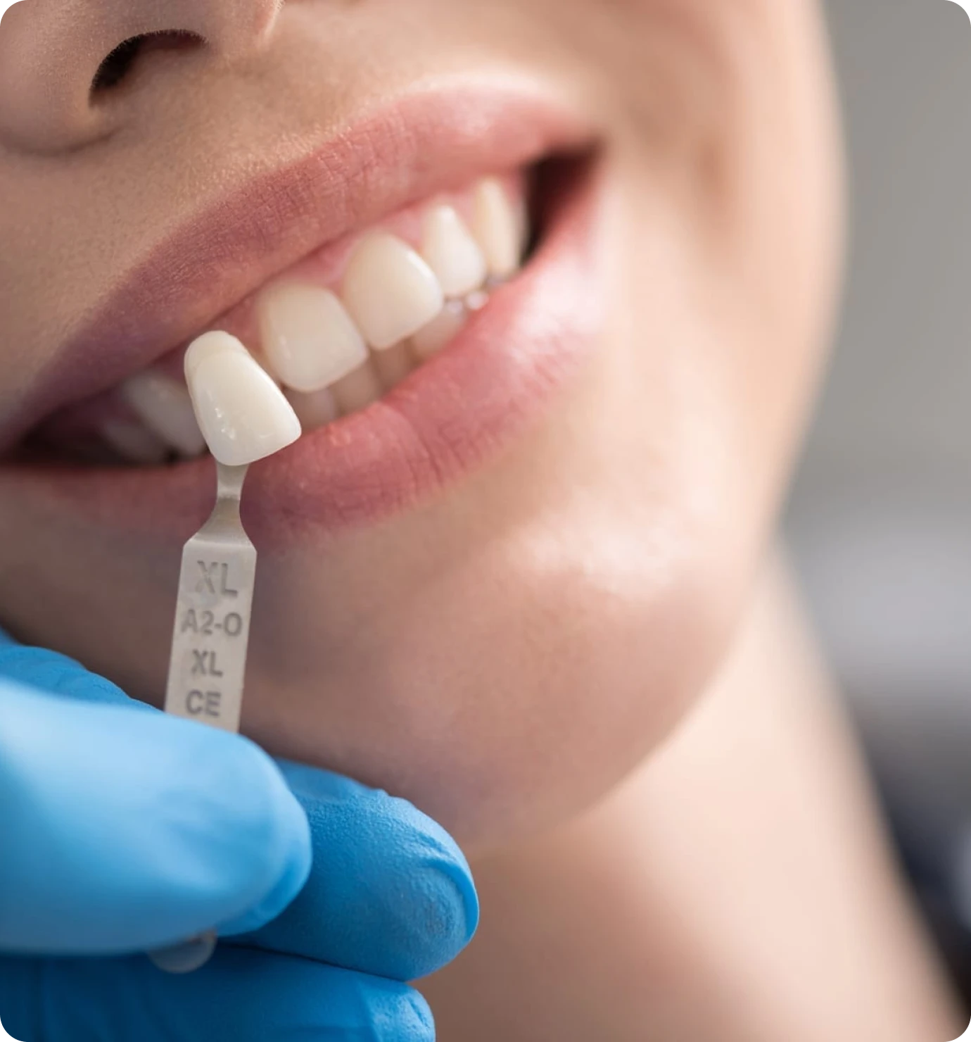 Soins dentaires, réhabilitation esthétique et fonctionnelle au cabinet dentaire 126 à Paris (75011)