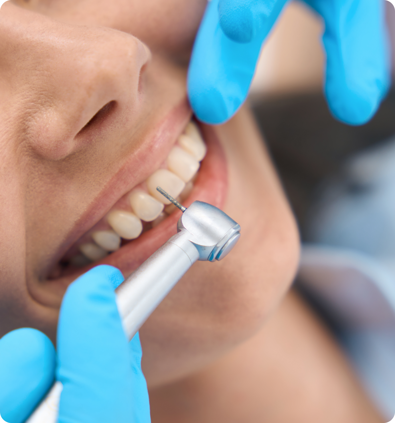 chirurgie-dentaire-paris-11